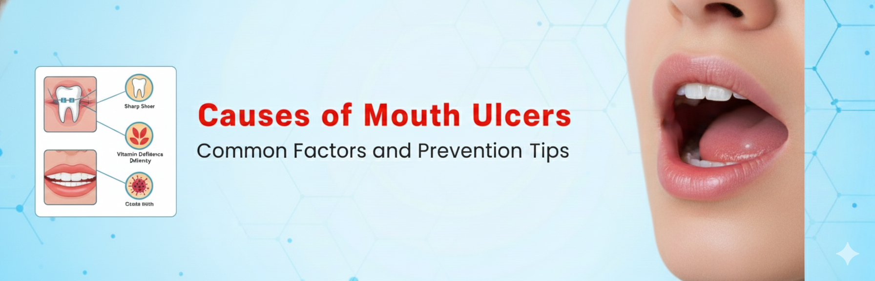  Causes of Mouth Ulcers in Hindi